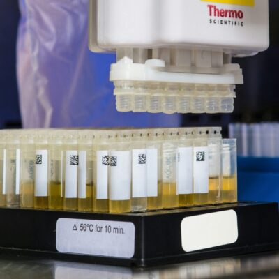 What Substances Can Be Detected Using Urine Drug Tests? A Comprehensive Guide